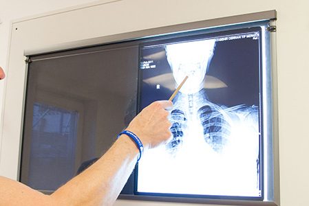 Röntgen-Diagnose beim Chiropraktiker in Köln